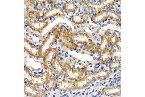 Immunohistochemistry of paraffin-embedded mouse kidney using ZFAND3 antibody (ABIN5975562) at dilution of 1/100 (40x lens). (ZFAND3 Antikörper)