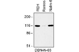 Western blotting analysis of drebrin expression in REH, Ramos, and Nalm-6 cell lysate using mouse monoclonal antibody DBN-N-03 . (DBN1 Antikörper  (AA 1-326) (PE))