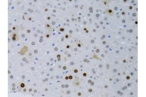 Immunohistochemistry of paraffin-embedded mouse liver using PCNA antibody (ABIN5970094) at dilution of 1/100 (40x lens). (PCNA Antikörper)