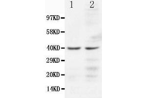 Anti-CCR5 antibody, Western blotting Lane 1: JURKAT Cell Lysate Lane 2: COLO320 Cell Lysate (CCR5 Antikörper  (N-Term))