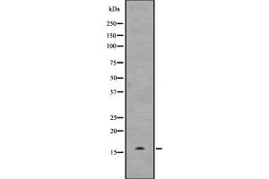 Western blot analysis of UBE2D3 expression in Hela cell lysate,The lane on the left is treated with the antigen-specific peptide. (UBE2D3 Antikörper)