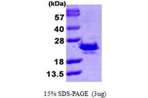 SDS-PAGE (SDS) image for Sorcin (SRI) (AA 1-198) protein (His tag) (ABIN667371)