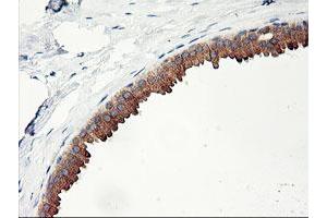 Immunohistochemical staining of paraffin-embedded Human breast tissue using anti-PHF21B mouse monoclonal antibody. (PHF21B Antikörper)
