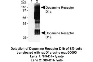 Image no. 1 for anti-Dopamine Receptor D1 (DRD1) (C-Term) antibody (ABIN363247) (Dopamine Receptor d1 Antikörper  (C-Term))