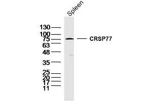 Mouse spleen lysates probed with CRSP77 Polyclonal Antibody, unconjugated  at 1:300 overnight at 4°C followed by a conjugated secondary antibody at 1:10000 for 90 minutes at 37°C. (MED17 Antikörper  (AA 181-280))
