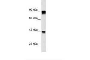 Image no. 1 for anti-Retinoblastoma Protein (Rb Protein) (AA 703-752) antibody (ABIN6735939) (Retinoblastoma Protein (Rb) Antikörper  (AA 703-752))
