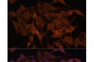 Immunofluorescence analysis of HeLa cells using TLR3 Polyclonal Antibody at dilution of 1:100. (TLR3 Antikörper)