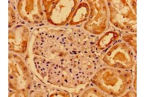 Immunohistochemistry of paraffin-embedded human kidney tissue using ABIN7160238 at dilution of 1:100 (SMAD4 Antikörper  (AA 27-195))