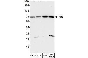 Western Blotting (WB) image for anti-Fused in Sarcoma (FUS) (AA 400-450) antibody (ABIN7453433) (FUS Antikörper  (AA 400-450))