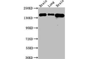 Western Blot Positive WB detected in: Rat Brain whole cell lysate, Rat Lung whole cell lysate, Mouse Brain whole cell lysate All lanes: FGFR2 Antibody at 1:1000 Secondary Goat polyclonal to rabbit IgG at 1/50000 dilution Predicted band size: 93, 87, 93, 77, 92, 89, 86, 29, 80, 93, 97, 92, 41, 80, 80, 77, 80 kDa Observed band size: 145 kDa (Rekombinanter FGFR2 Antikörper)