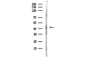 anti-Pepsinogen C (PGC) (Internal Region) antibody