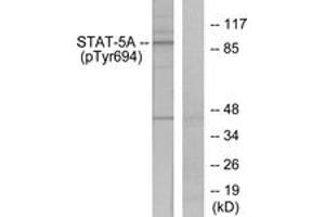 Western blot analysis of extracts from HeLa cells treated with EGF, using STAT5A (Phospho-Tyr694) Antibody.