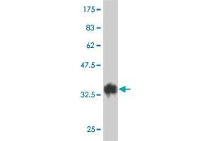 Western Blot detection against Immunogen (38. (TAF5L Antikörper  (AA 1-117))