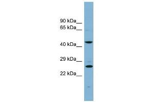 VPS28 antibody used at 1 ug/ml to detect target protein. (VPS28 Antikörper)