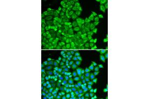 Immunofluorescence analysis of HeLa cell using CSRP1 antibody. (CSRP1 Antikörper)