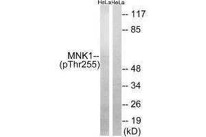 Western Blotting (WB) image for anti-MAP Kinase Interacting serine/threonine Kinase 1 (MKNK1) (pThr255) antibody (ABIN1847624) (MKNK1 Antikörper  (pThr255))