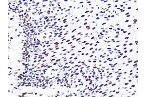 Immunohistochemistry of paraffin-embedded human esophageal using DDB1 Rabbit mAb (ABIN7266673) at dilution of 1:100 (40x lens). (DDB1 Antikörper)