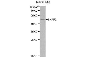 Western blot analysis of extracts of mouse lung, using SKAP2 antibody. (SKAP2 Antikörper)