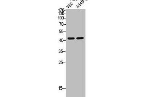 Western Blot analysis of VEC A549 cells using Cleaved-MMP-12 (G106) Polyclonal Antibody (MMP12 Antikörper  (Cleaved-Gly106))