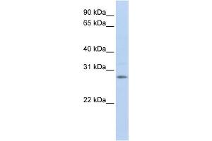 WB Suggested Anti-IGFBP4 Antibody Titration:  1 ug/ml  Positive Control:  Fetal Brain Lysate (IGFBP4 Antikörper  (Middle Region))