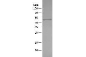 Western Blotting (WB) image for Protein Kinase, AMP-Activated, alpha 2 Catalytic Subunit (PRKAA2) (AA 340-552) protein (His-IF2DI Tag) (ABIN7124658)