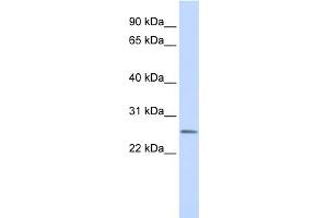 WB Suggested Anti-CEACAM4 Antibody Titration:  0. (CEACAM4 Antikörper  (N-Term))