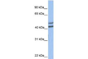 WB Suggested Anti-GALT Antibody Titration:  0.