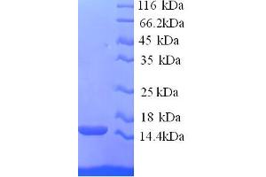 SDS-PAGE (SDS) image for Ring Finger Protein 7 (RNF7) (AA 2-113) protein (His tag) (ABIN4975948) (RNF7 Protein (AA 2-113) (His tag))