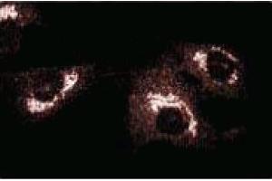 Immunofluorescence (IF) image for anti-Golgi Brefeldin A Resistant Guanine Nucleotide Exchange Factor 1 (GBF1) (AA 1266-1379) antibody (ABIN968745)