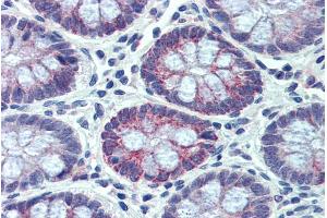 Immunohistochemistry (IHC) image for anti-Nuclear Receptor Subfamily 1, Group I, Member 2 (NR1I2) (Internal Region) antibody (ABIN335159)