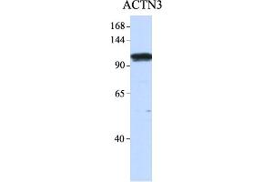 Western Blotting (WB) image for anti-Actinin, alpha 3 (ACTN3) (N-Term) antibody (ABIN2777061)