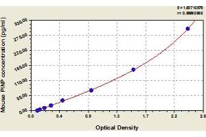 Procollagen I N-Terminal Propeptide (PINP) ELISA Kit
