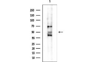 anti-Glutamate Dehydrogenase 2 (GLUD2) antibody