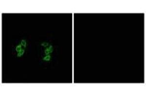 Immunofluorescence analysis of A549 cells, using CKI-α1/L antibody. (CSNK1A1L/CSNK1A1 Antikörper)