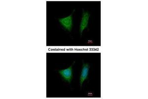 ICC/IF Image Immunofluorescence analysis of methanol-fixed HeLa, using EIF3 beta, antibody at 1:200 dilution. (EIF3I Antikörper)