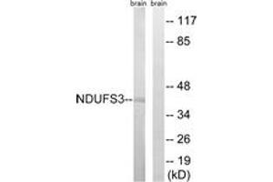 Western blot analysis of extracts from mouse brain cells, using NDUFS3 Antibody.