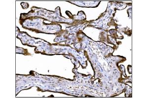IHC analysis of LRP1B using anti-LRP1B antibody (ABIN7601521). (LRP1B Antikörper  (AA 3704-4547))