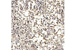 IHC analysis of Epac1/RAPGEF3 using anti-Epac1/RAPGEF3 antibody (ABIN7601858). (RAPGEF3 Antikörper  (AA 49-881))