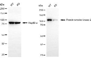 Western blotting analysis using protein tyrosine kinase 2 antibody (ABIN7800062).