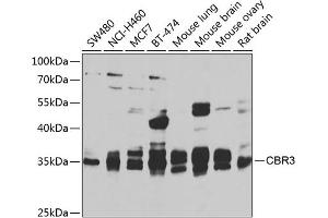 Western blot analysis of extracts of various cell lines, using CBR3 antibody  at 1:1000 dilution. (CBR3 Antikörper  (AA 118-277))