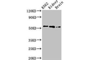 Western Blot Positive WB detected in: K562 whole cell lysate, Rat kidney tissue, Rat brain tissue All lanes: PFKFB2 antibody at 3 μg/mL Secondary Goat polyclonal to rabbit IgG at 1/50000 dilution Predicted band size: 59, 55 kDa Observed band size: 55 kDa (PFKFB2 Antikörper  (AA 360-505))
