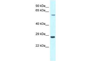 WB Suggested Anti-CPNE3 Antibody Titration: 1. (Copine III Antikörper  (C-Term))