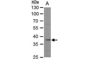 WB Image LDH-B antibody detects LDH-B protein by western blot analysis.