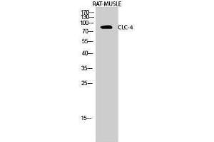 Western Blotting (WB) image for anti-Chloride Channel 4 (CLCN4) (Internal Region) antibody (ABIN3183949) (CLCN4 Antikörper  (Internal Region))