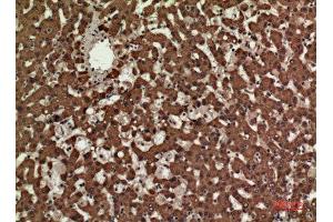 Immunohistochemistry (IHC) image for anti-CD3 epsilon (CD3E) (Internal Region) antibody (ABIN6283246)