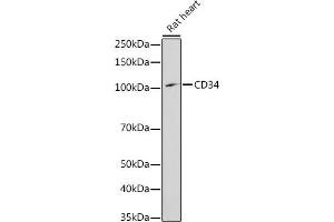 Western blot analysis of extracts of Rat heart, using CD34 antibody (ABIN3021123, ABIN3021124, ABIN3021125, ABIN1512704 and ABIN6213981) at 1:1000 dilution. (CD34 Antikörper  (AA 32-290))