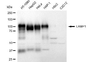 Western blotting analysis using LAMP1 antibody (ABIN7799308).