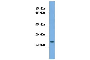 Host:  Rabbit  Target Name:  FAP  Sample Type:  COLO205 Whole cell lysates  Antibody Dilution:  1. (FAP Antikörper  (C-Term))