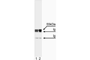 Immunoprecipitation/western blot analysis of caspase-8. (Caspase 8 Antikörper  (full length))