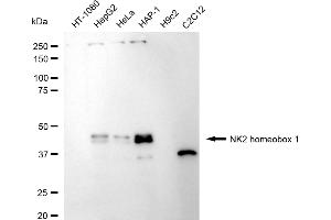 Western blotting analysis using NK2 homeobox 1 antibody (ABIN7799606). (Rekombinanter NKX2-1 Antikörper)